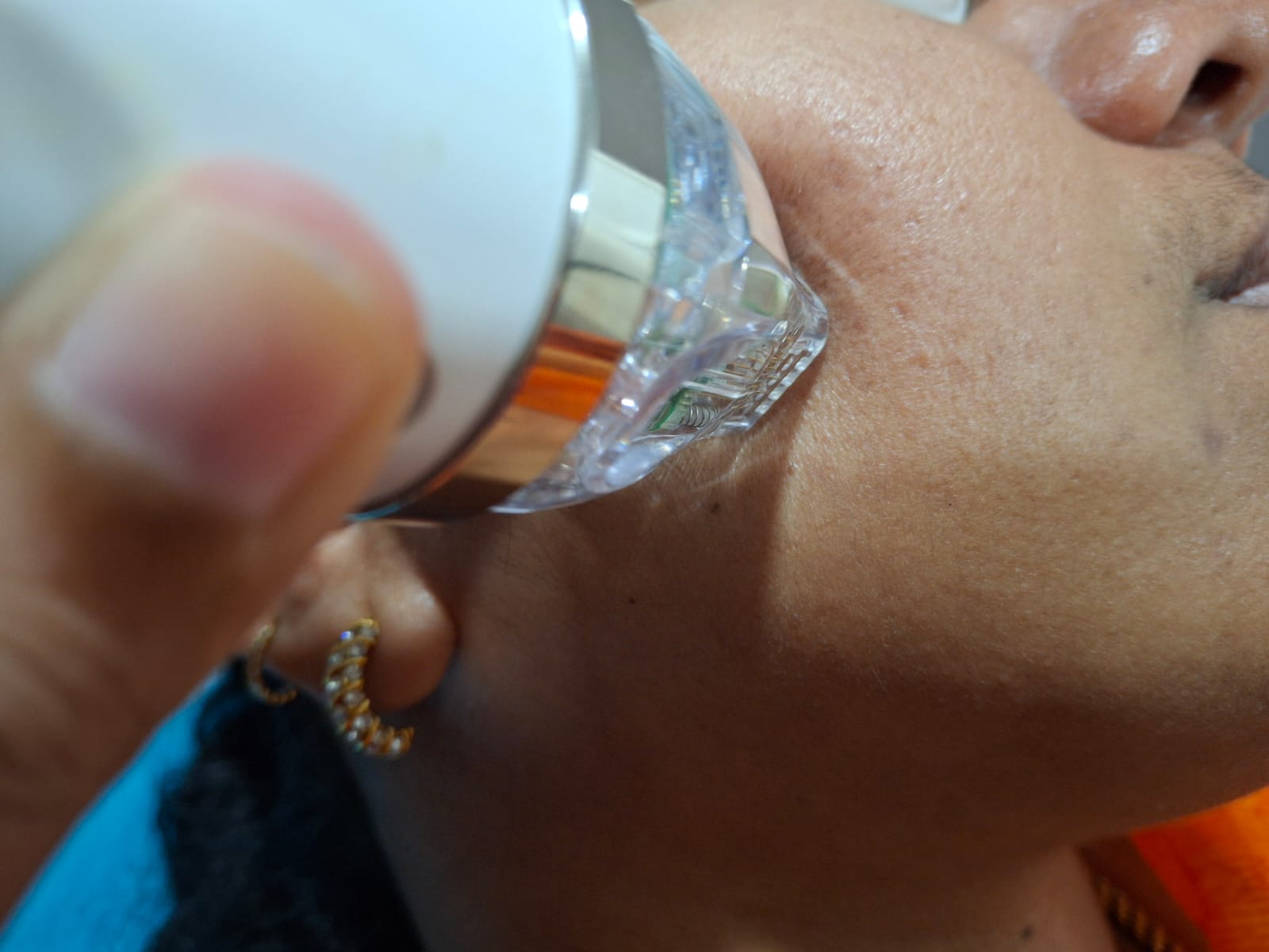 Patch Test Procedure