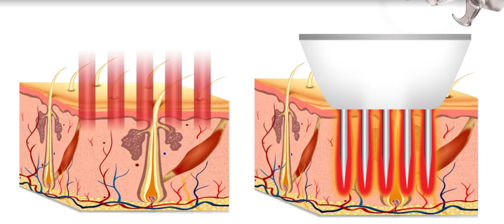 Patch Test Procedure