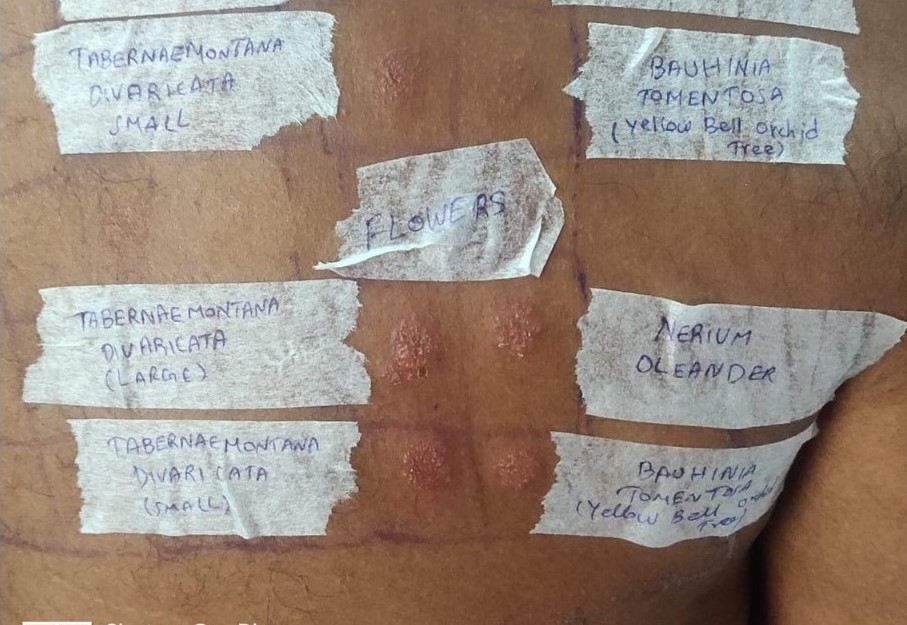 Patch Test Procedure