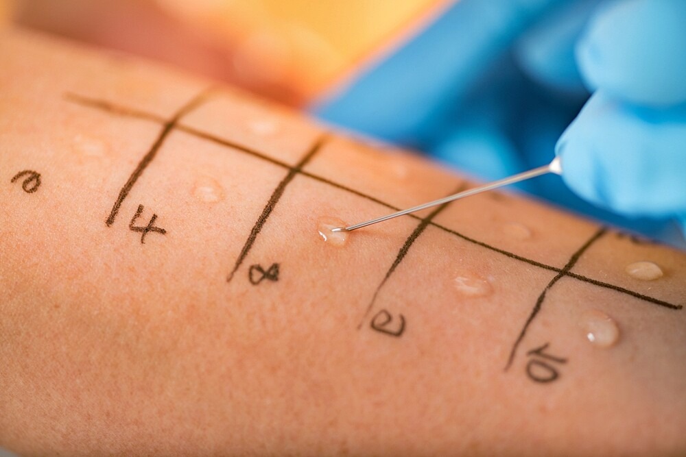 Patch Test Procedure